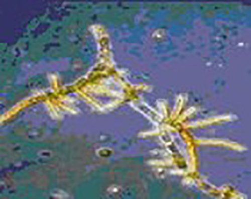 microrganismi al telescopio in ambiente da disinfestare