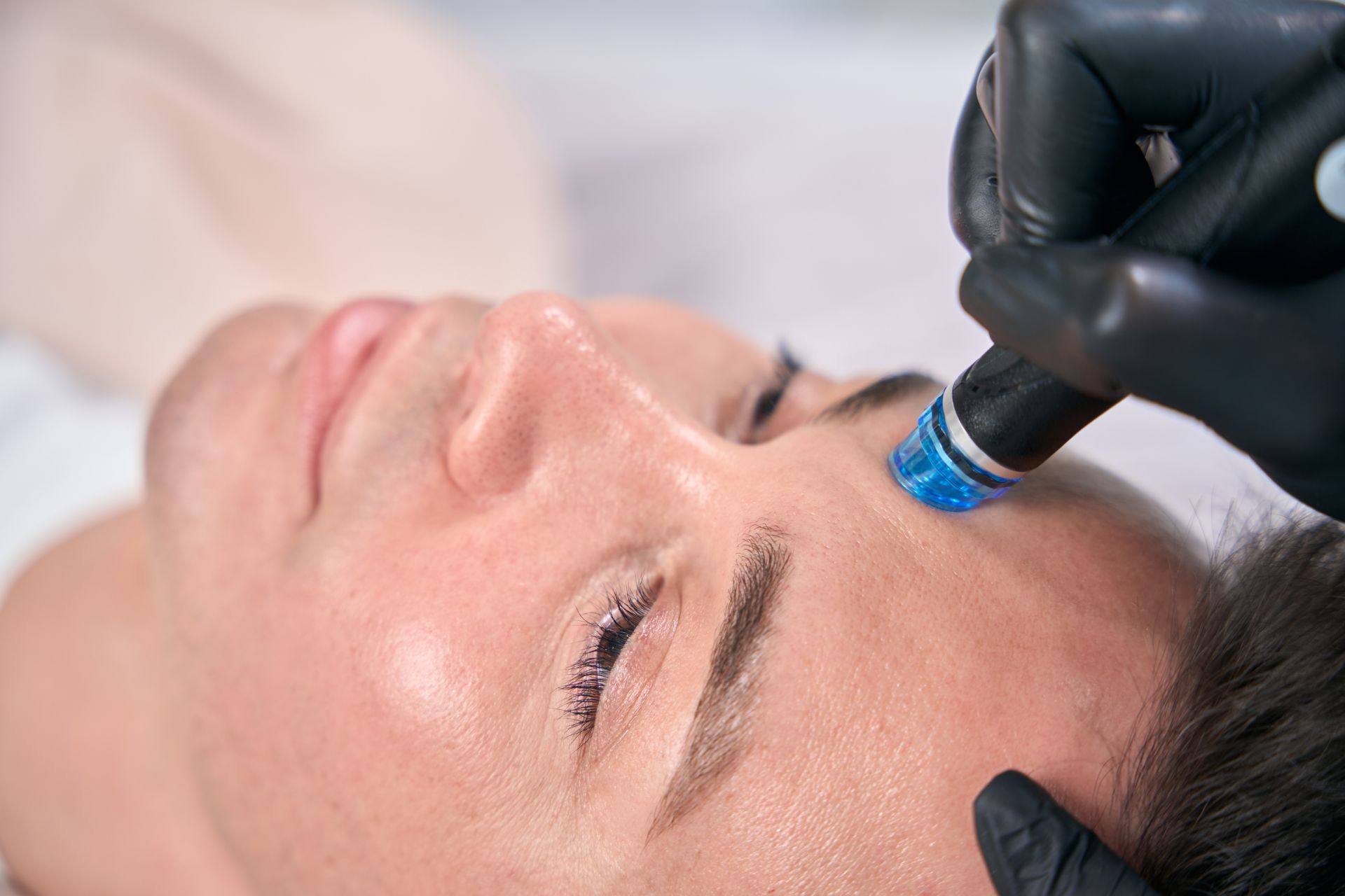 Person receiving a hydrafacial treatment on the forehead, held by gloved hand. Blue device against skin.