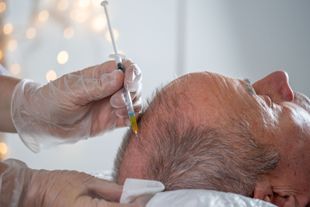 A person receives a scalp injection; a gloved hand holds a syringe.
