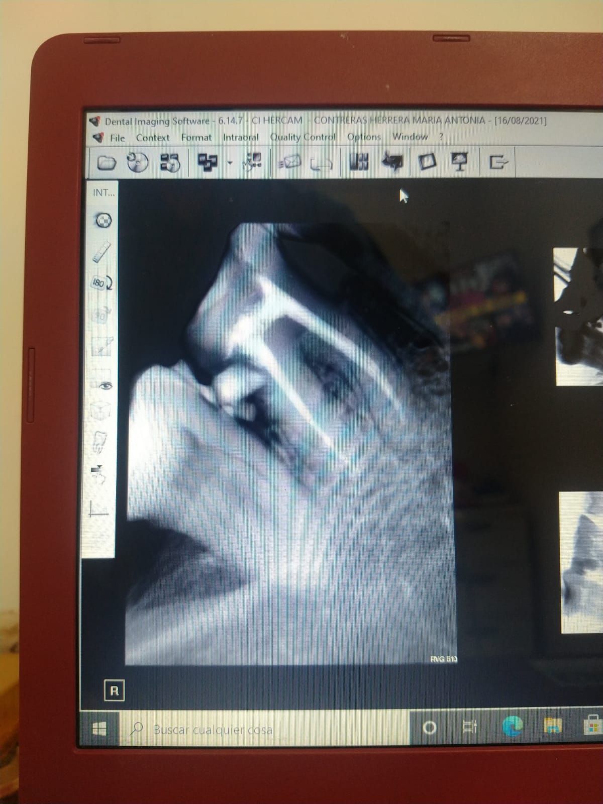 CLÍNICA INTEGRAL HERCAM