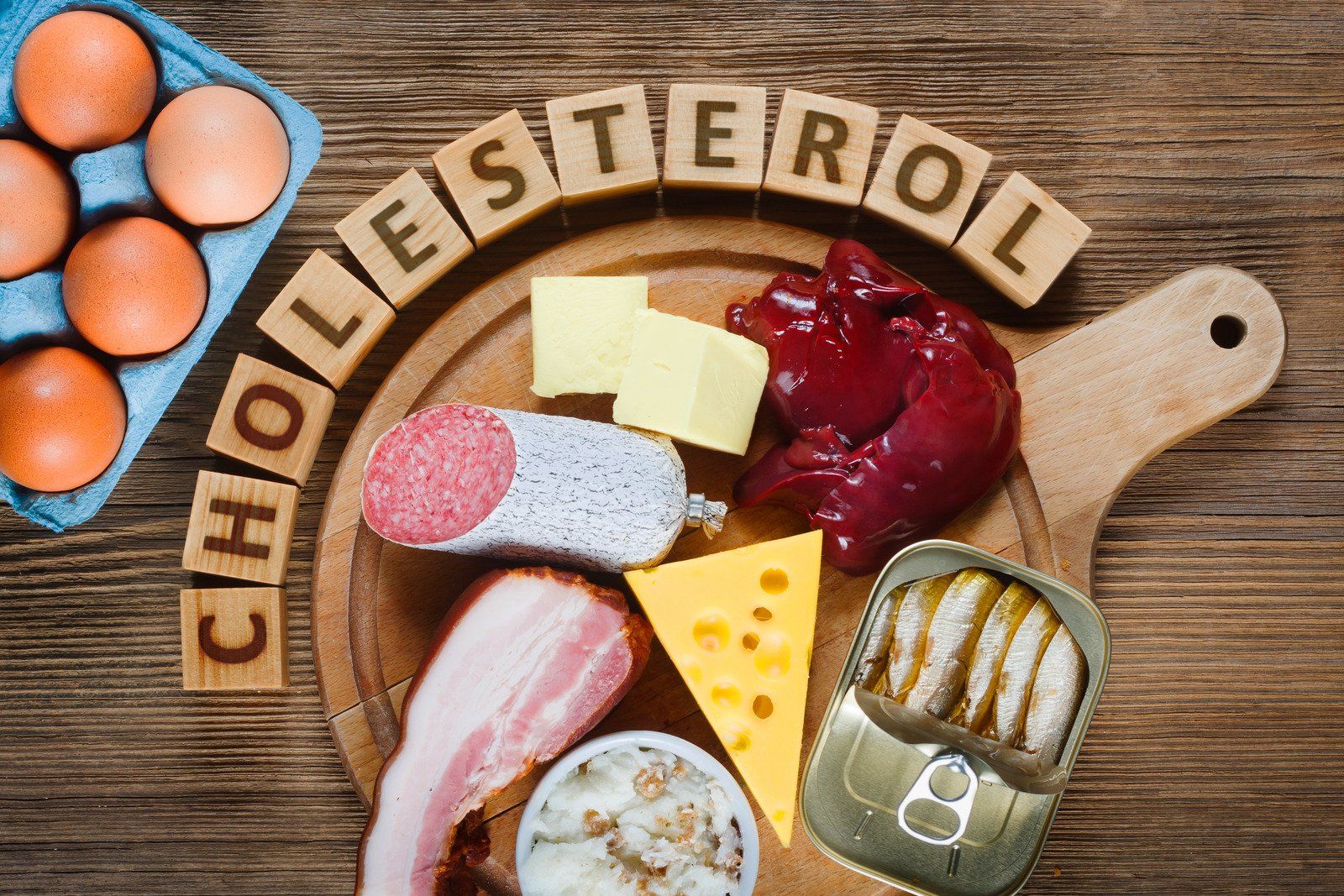 Foods high in cholesterol: eggs, butter, liver, salami, bacon, cheese, and sardines.