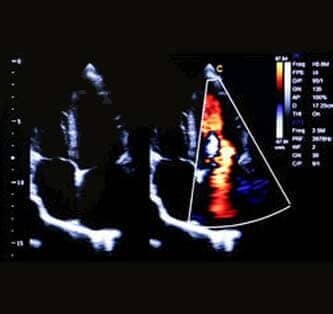 Dr. Antonio Emilio González Font - cardiólogo pediatra