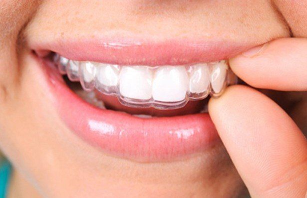 Confiar Odontologia - INVISALIGN Você tomou a decisão de usar os