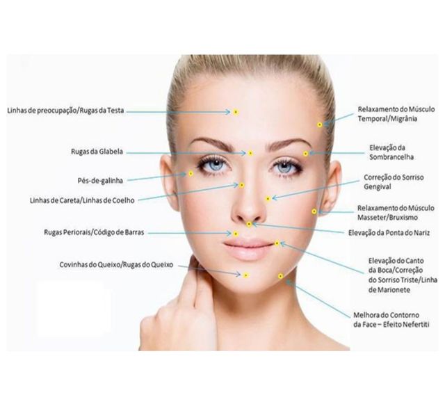 Curvas Da Face - Harmonização Orofacial - Santos Publicações • 40 Anos de  Editorial Médico e Odontológico