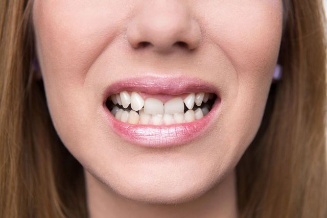 várias bocas em posições diferentes. com dentes, língua, sorriso