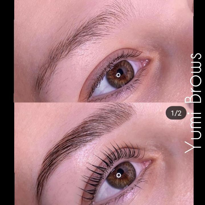 Une photo avant et après des sourcils d'une femme