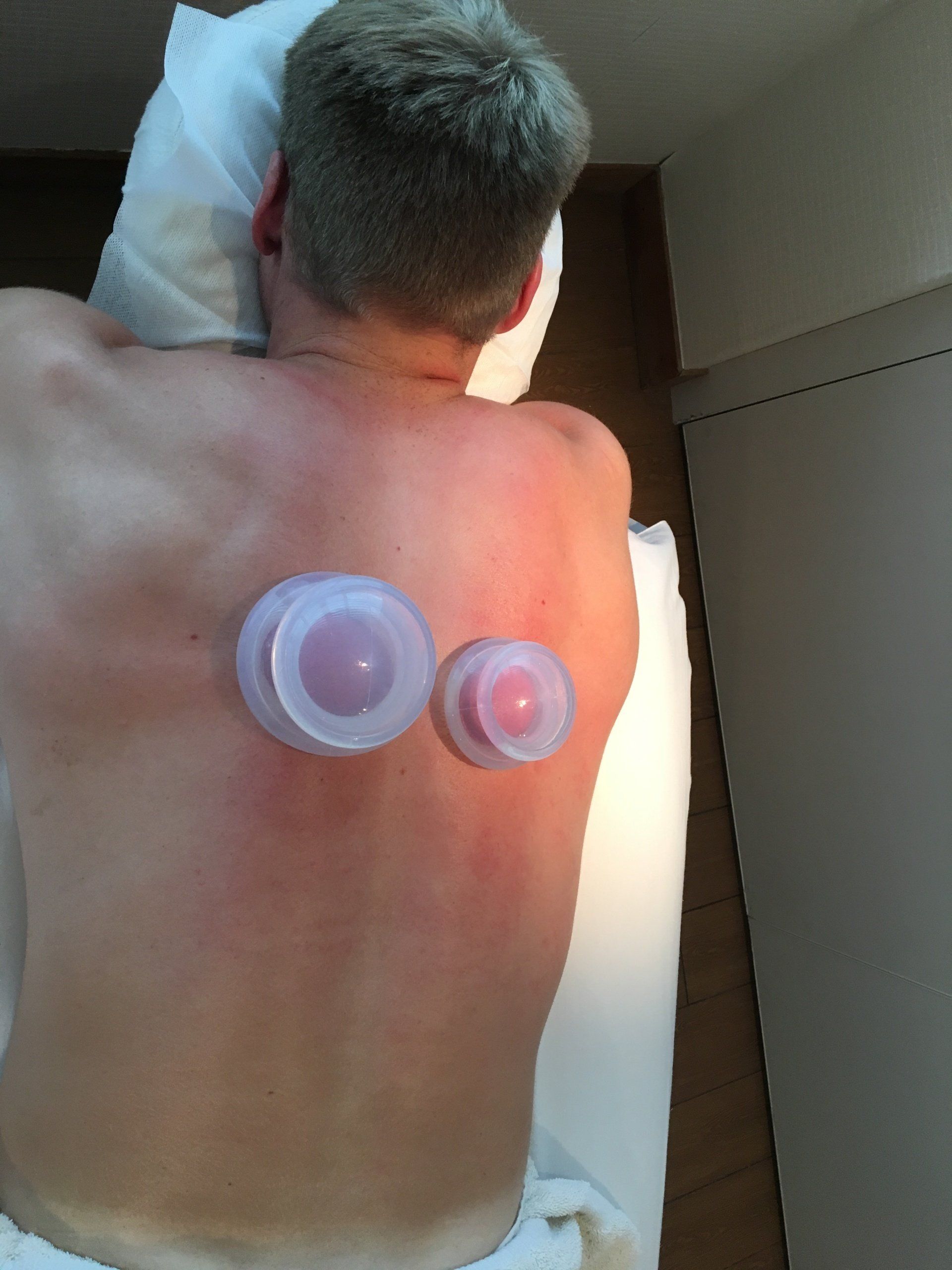 Cupping service performed by Reiko Mitani on the Seabourn Quest