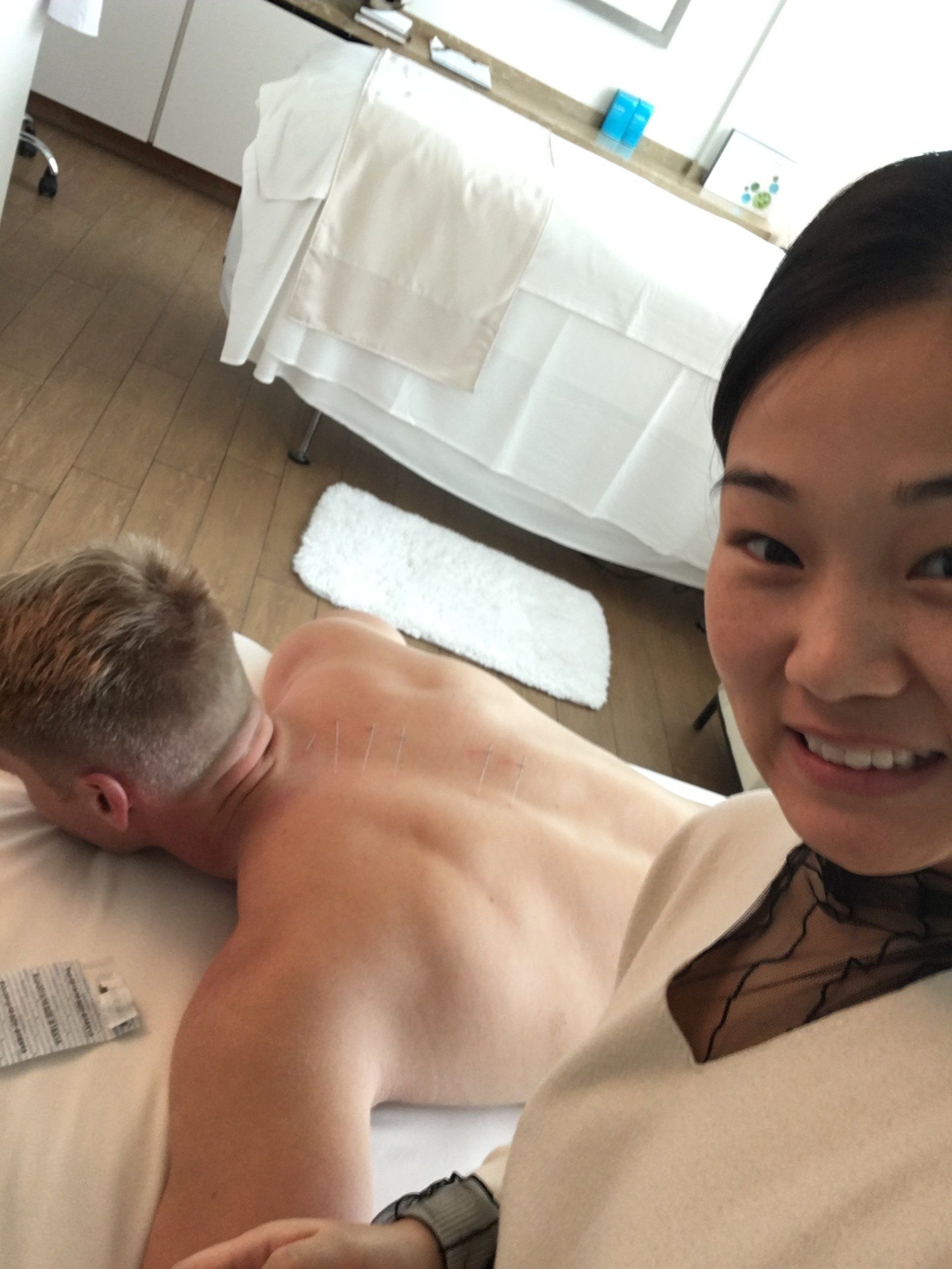 Qiana XU performing acupuncture on Xander Clemens's back