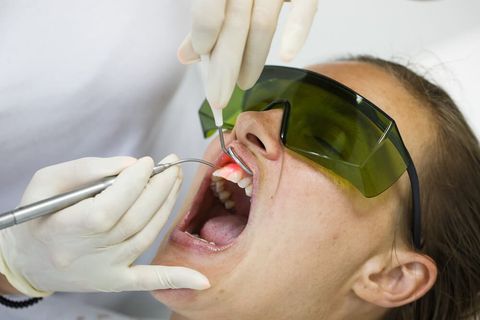 Laser Gum Treatments