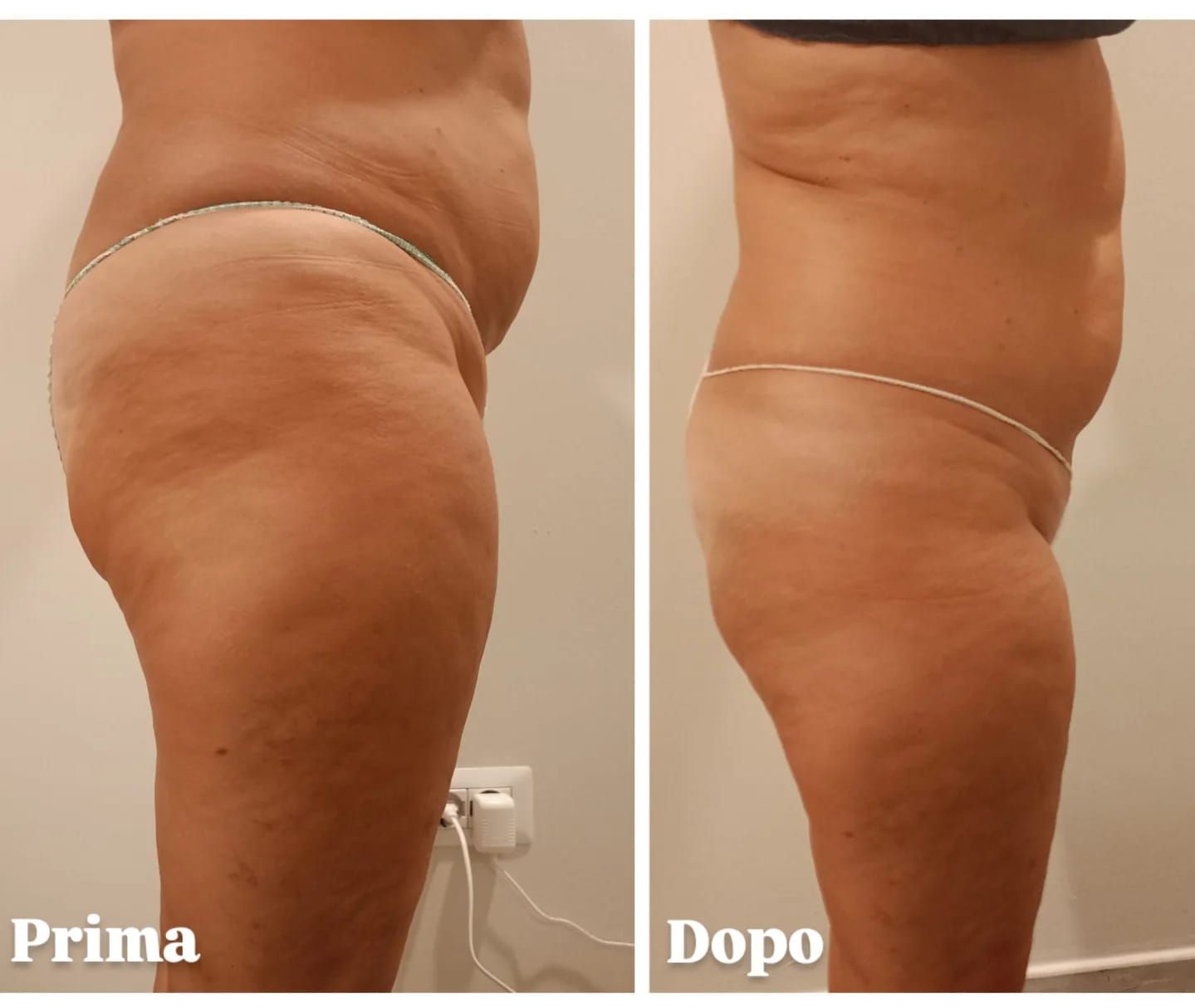 Una donna si sta facendo fare un massaggio alla gamba.