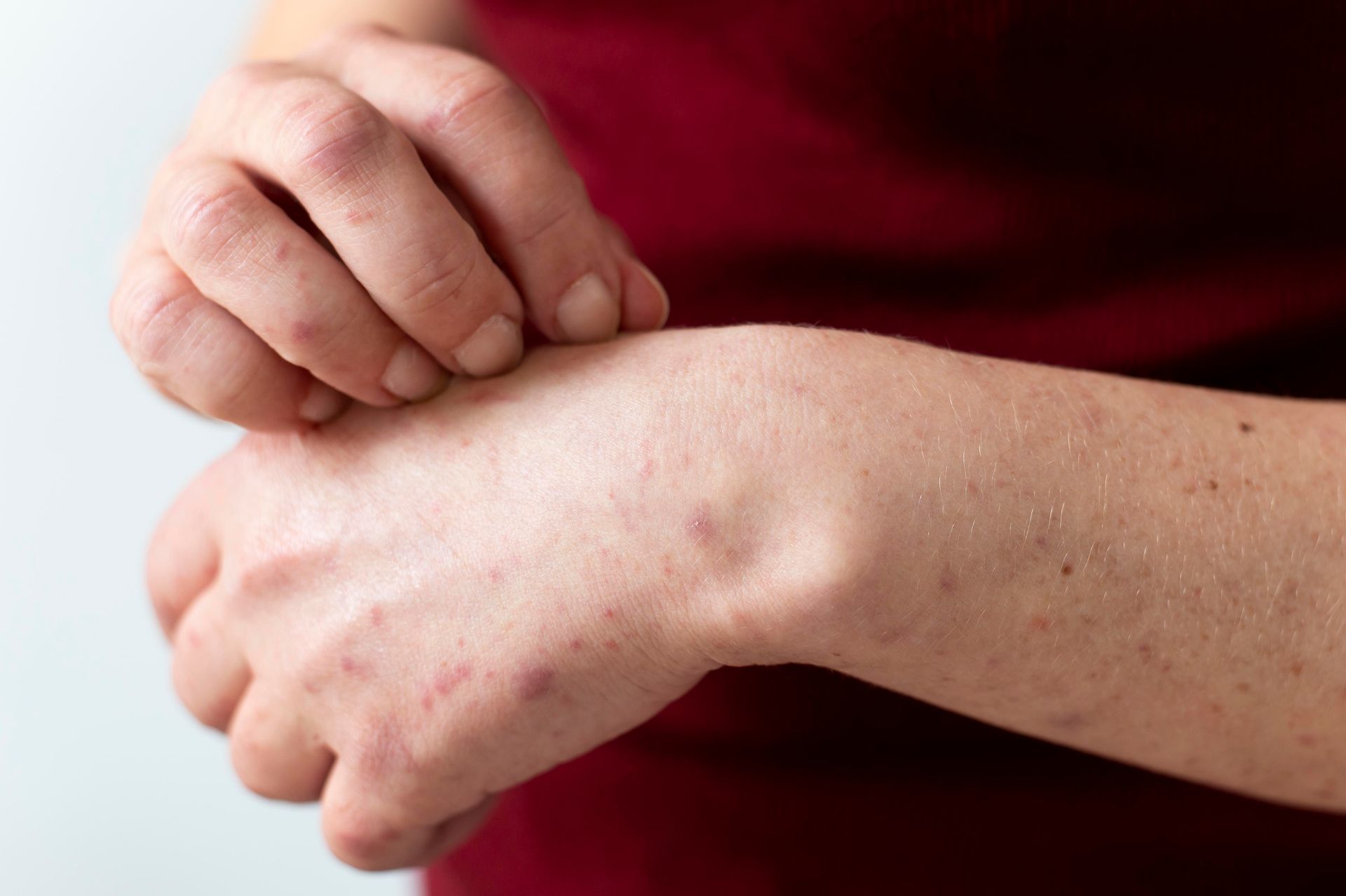 A woman is scratching her wrist with her hands.