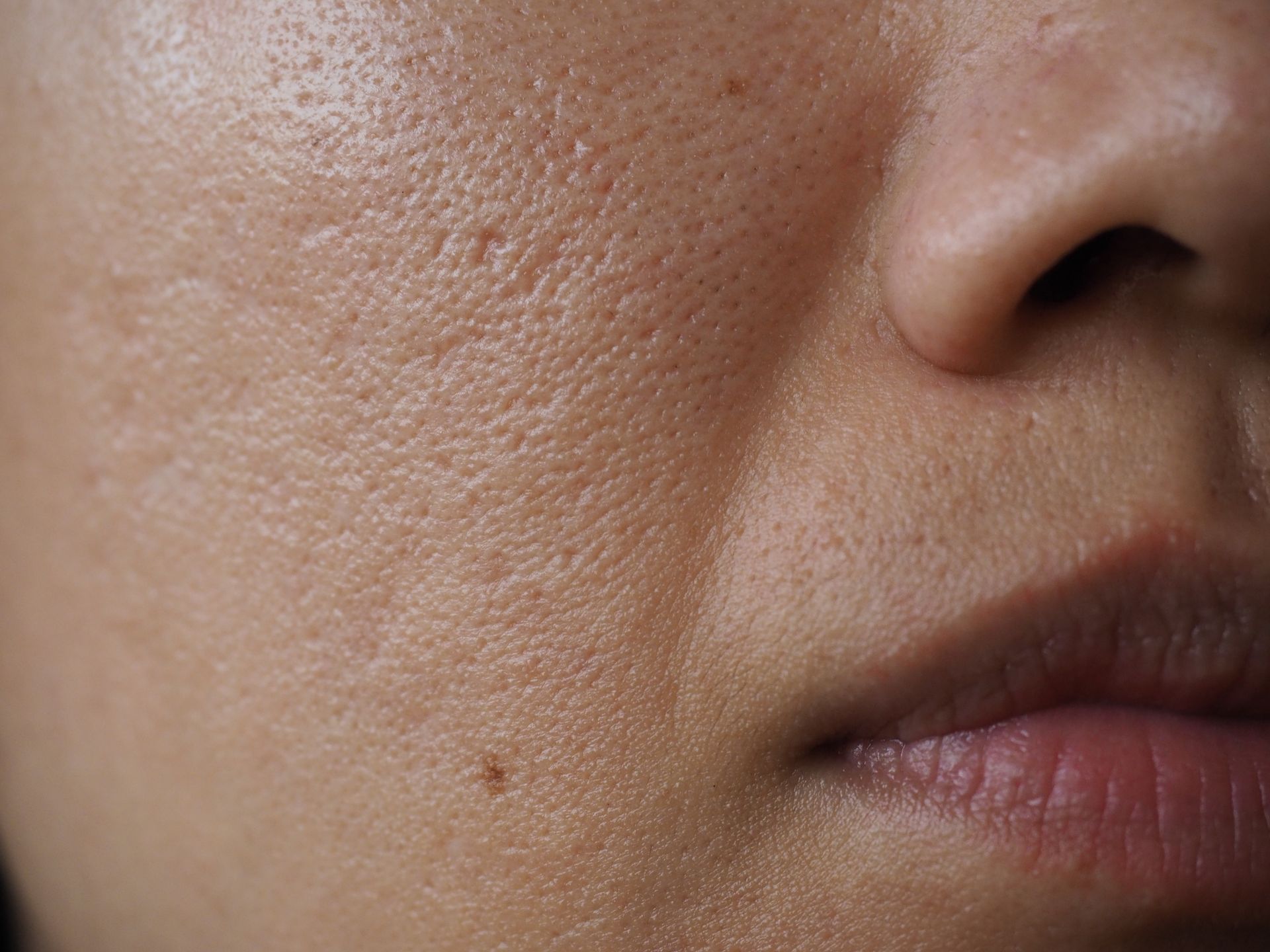 A close up of a woman 's face with a lot of pores.