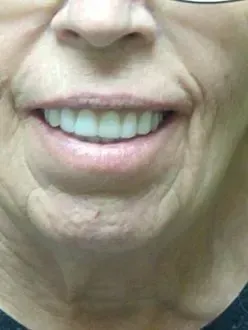 A close up of a woman's face with glasses and a smile.