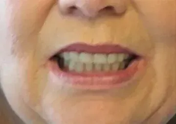 A close up of a woman's mouth with her teeth showing.