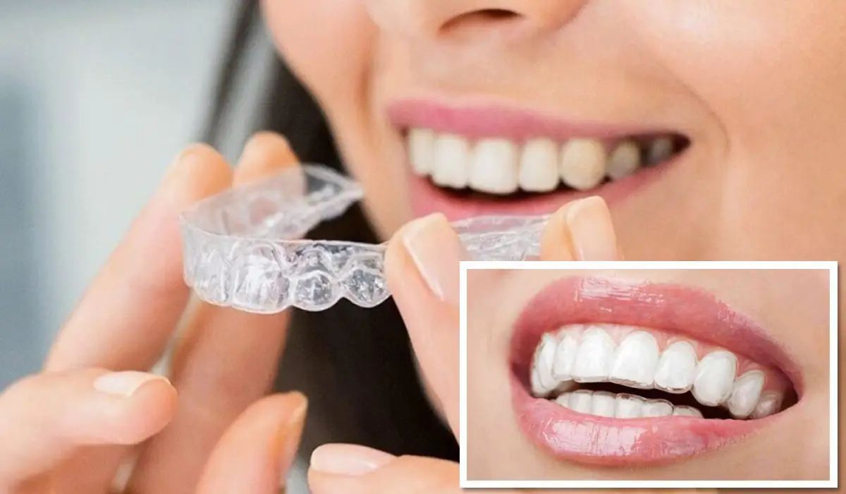 Person holding clear aligners near a smiling mouth, with a close-up inset showing straight white teeth.