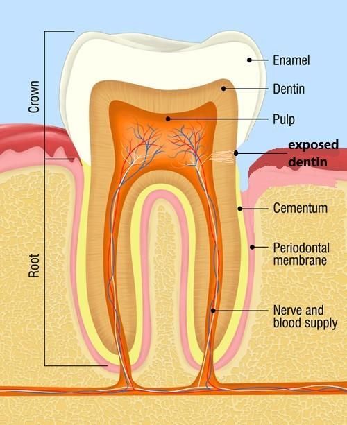 Tooth and gum diagram
