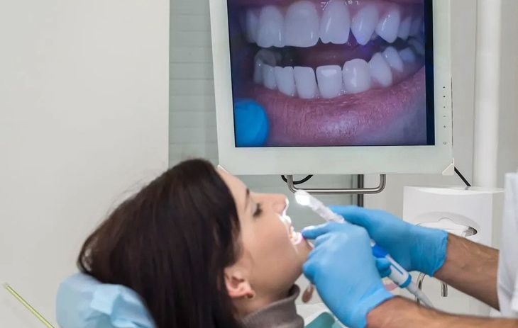 dental sealants at aurora dental care