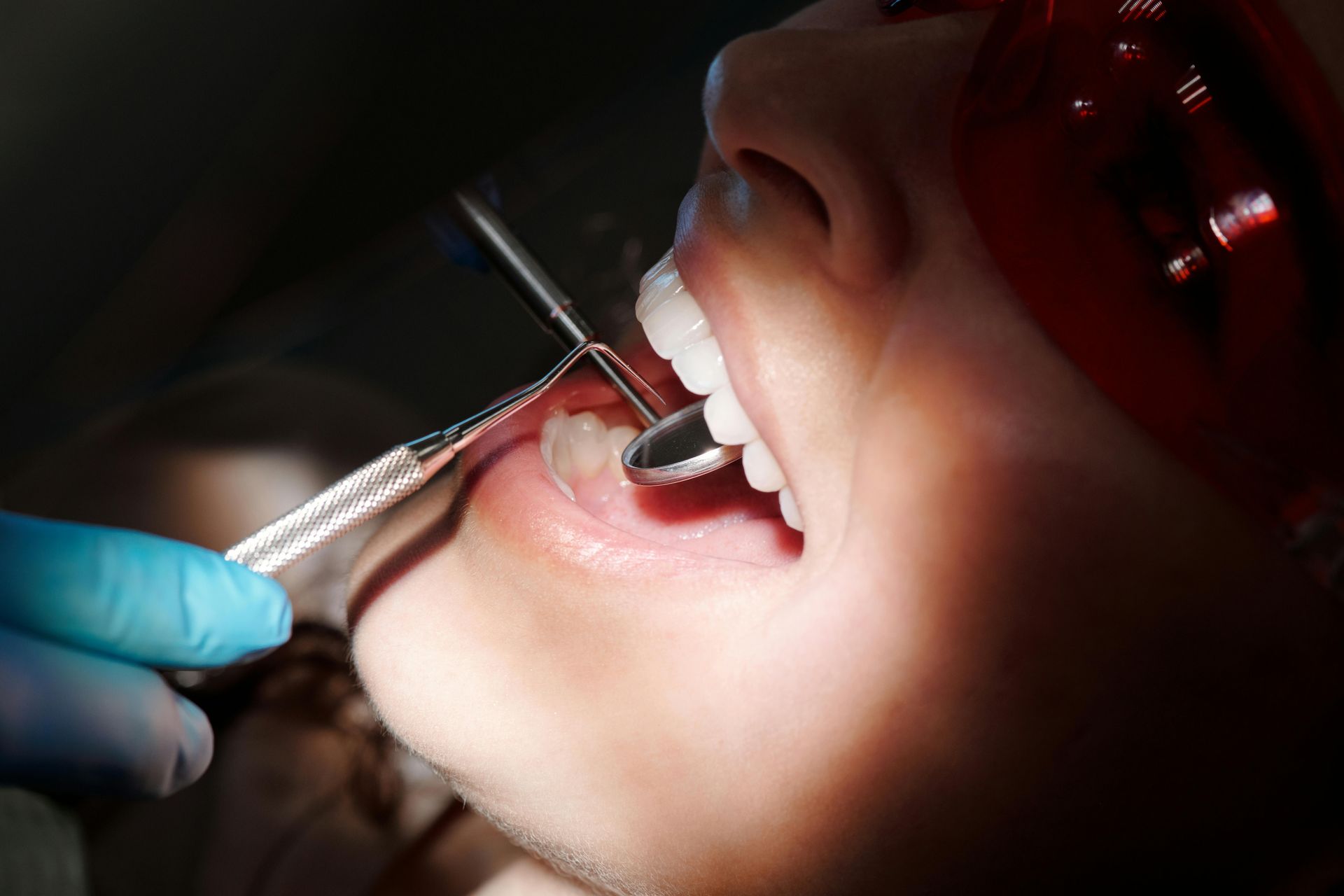 Gum Graft Procedure