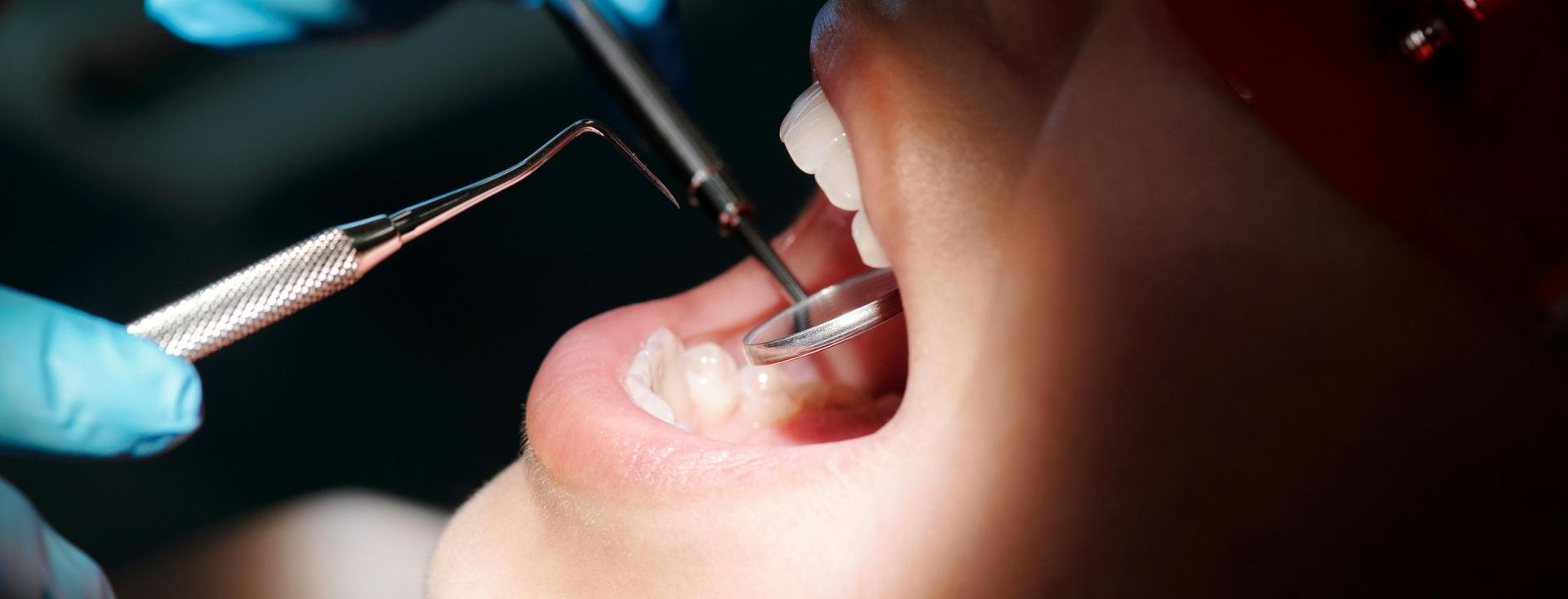 Dental exam for sensitive teeth