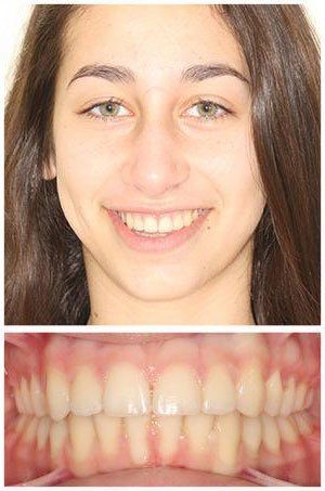 Smiling woman with green eyes, straight teeth, and pink gums.