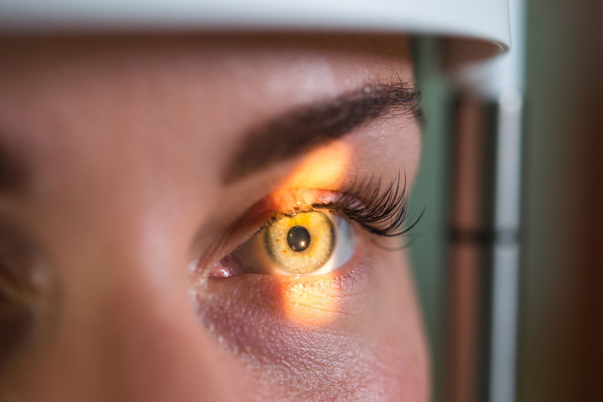 Close-up of a human eye being examined by a slit-lamp microscope with a bright yellow light directed at the iris.