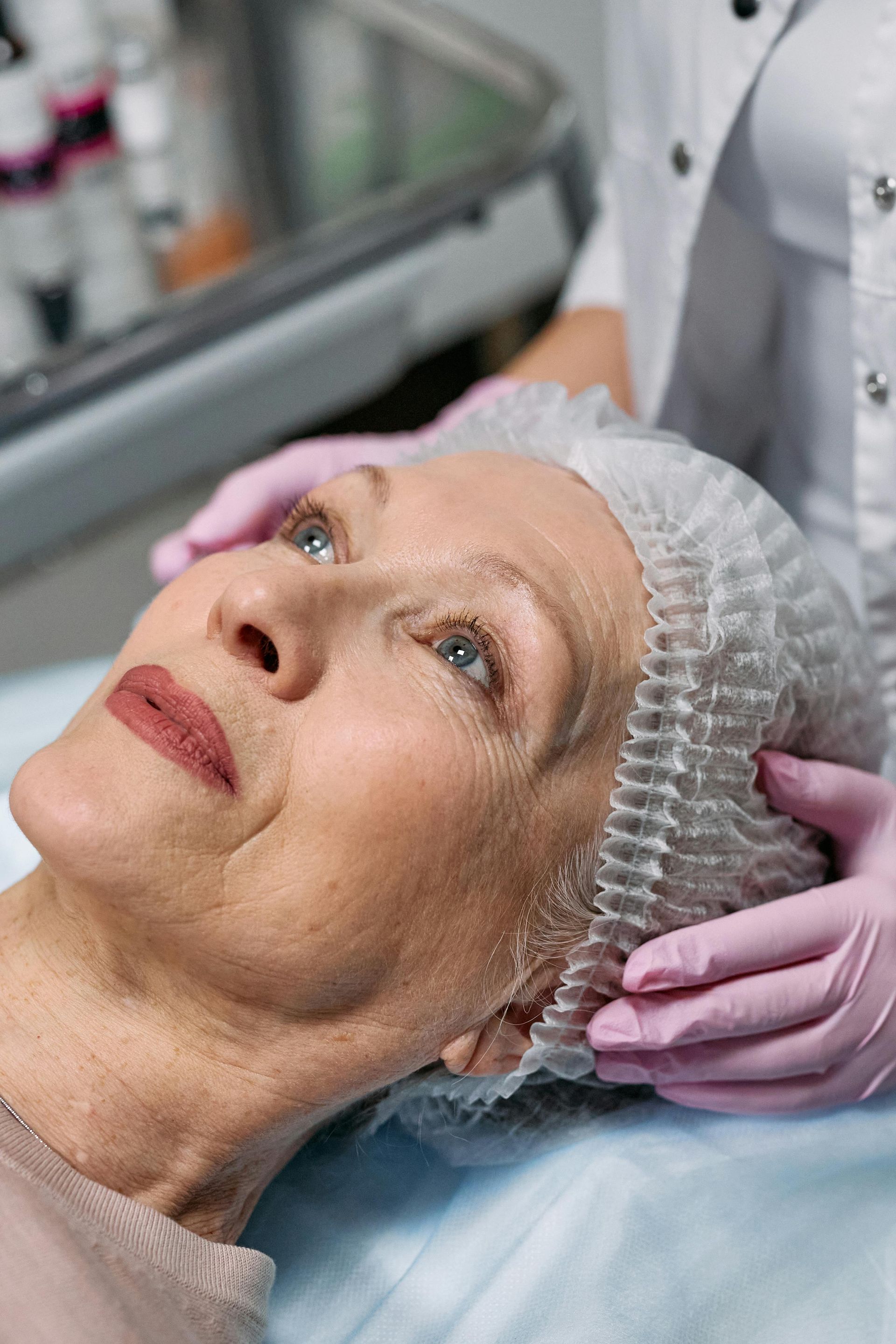RF microneedling device delivering radiofrequency energy into the skin for collagen stimulation.