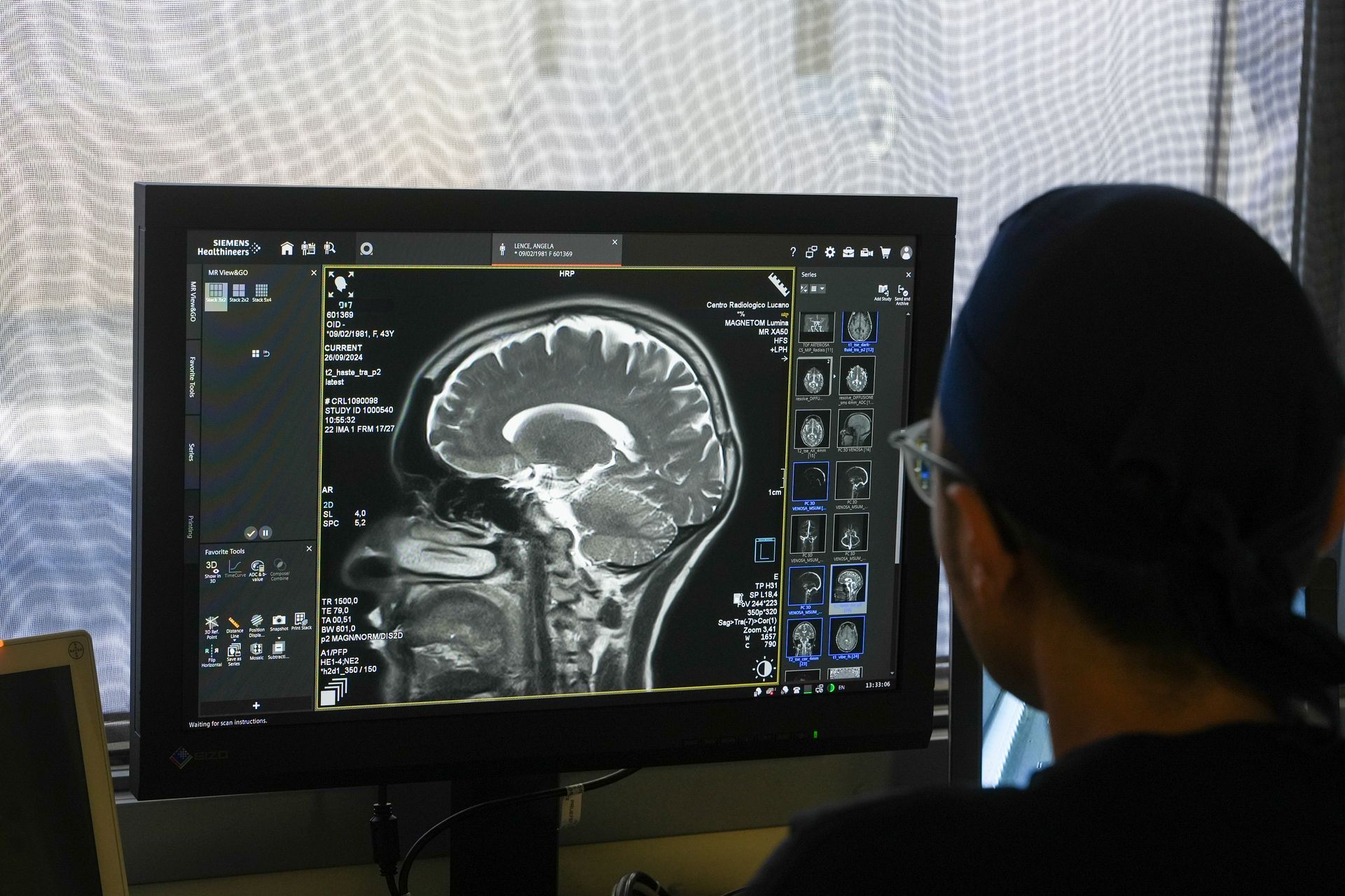 Armentano Risonanza Risonanza a Matera | Centro Radiologico Lucano