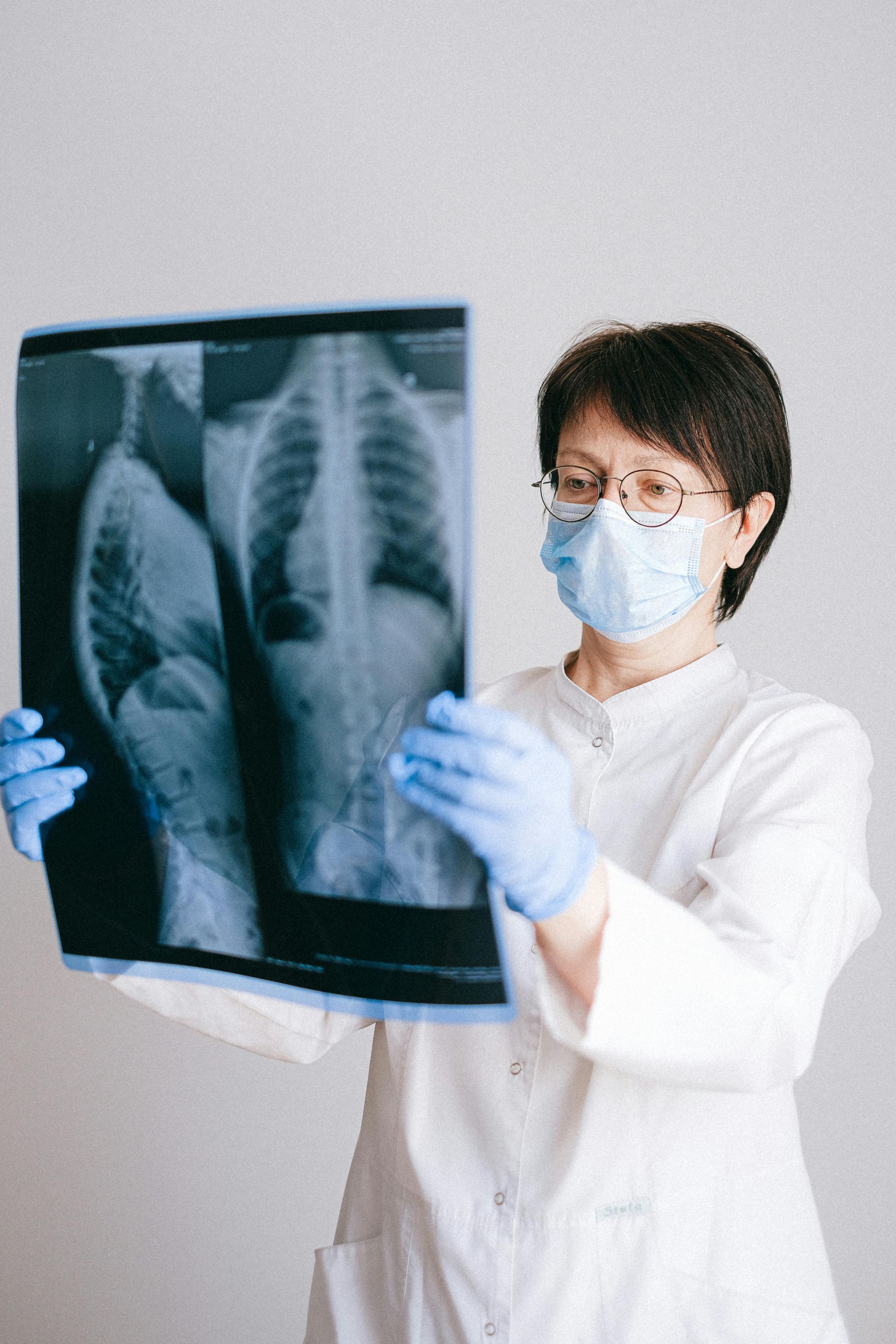 A doctor wearing a mask and gloves is holding an x-ray of a person 's chest.