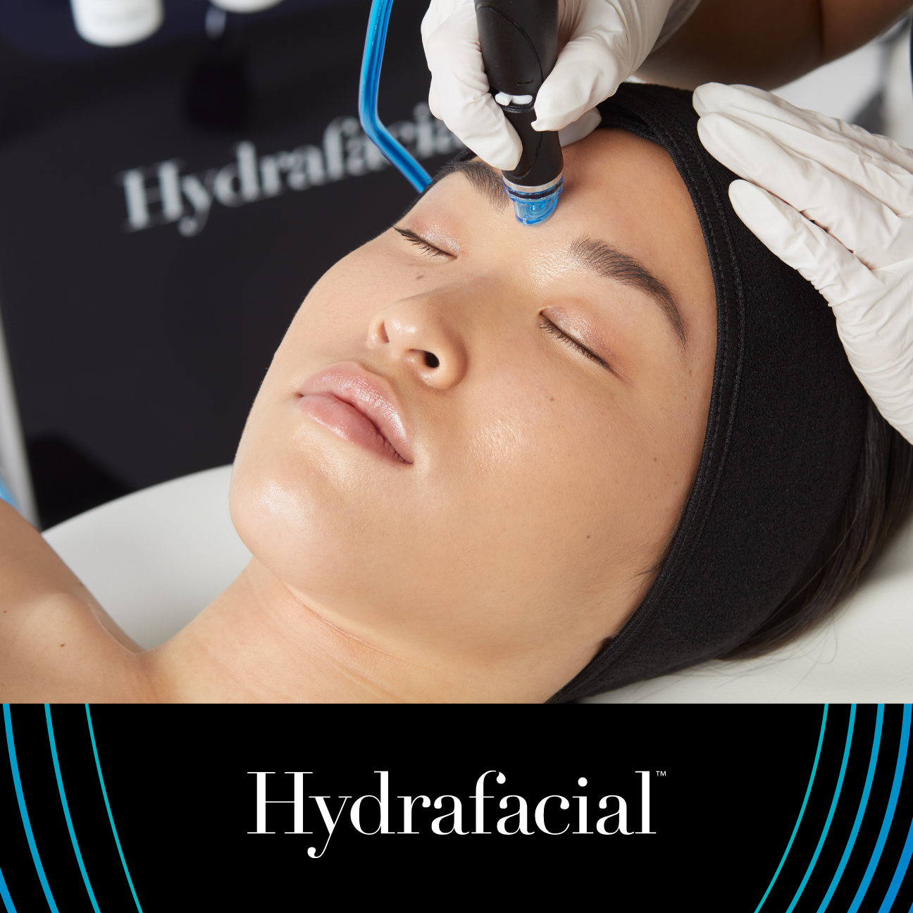 Professional HydraFacial treatment being performed on a woman’s forehead, highlighting advanced skin