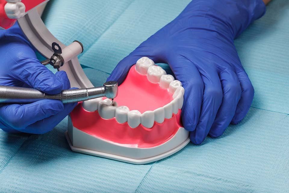 Terapia dell'endodonto