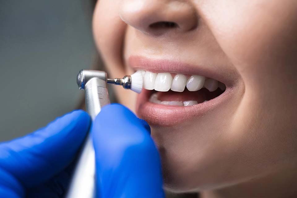 Pulizia e sbiancamento