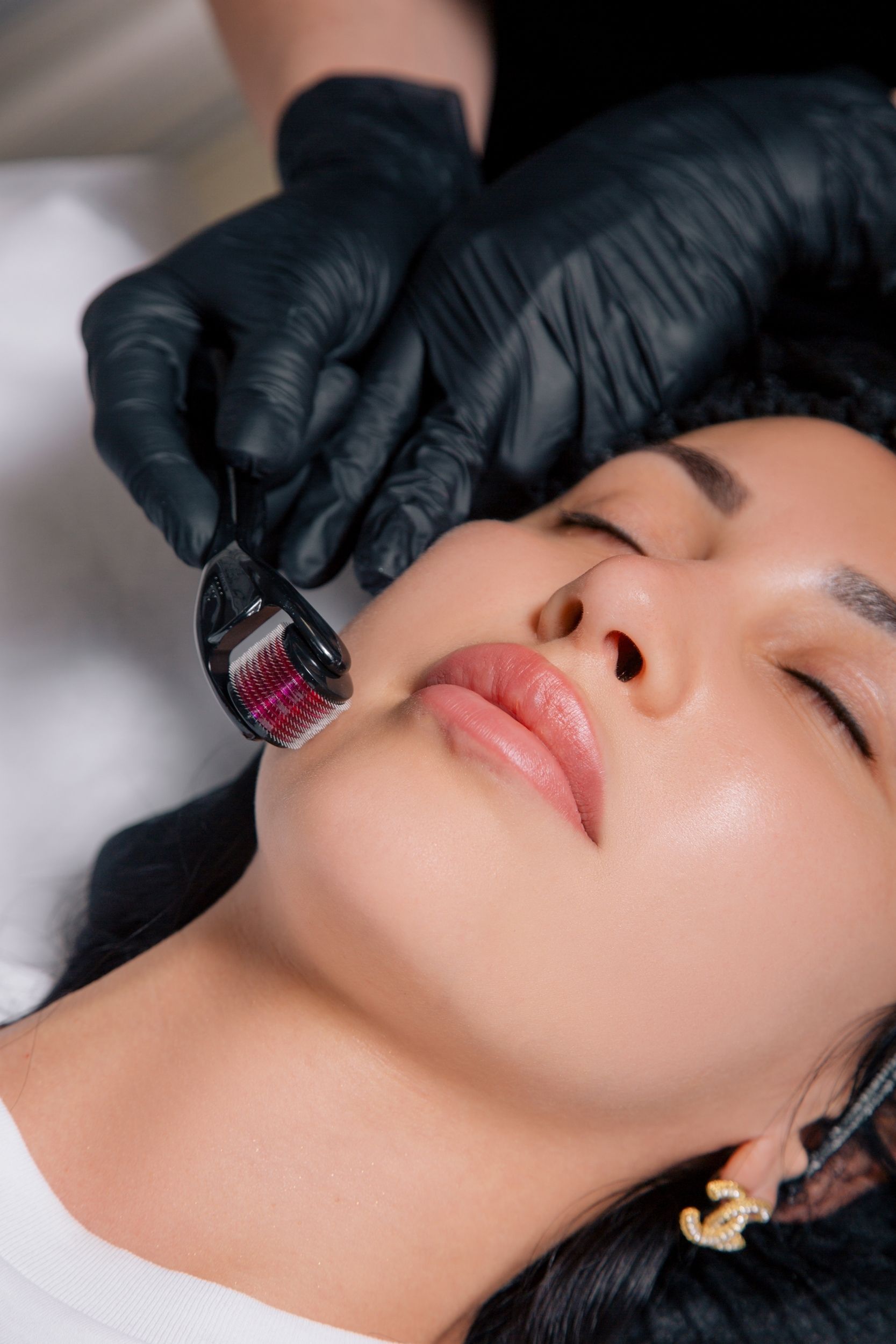 A woman is getting a facial treatment with a roller on her face.
