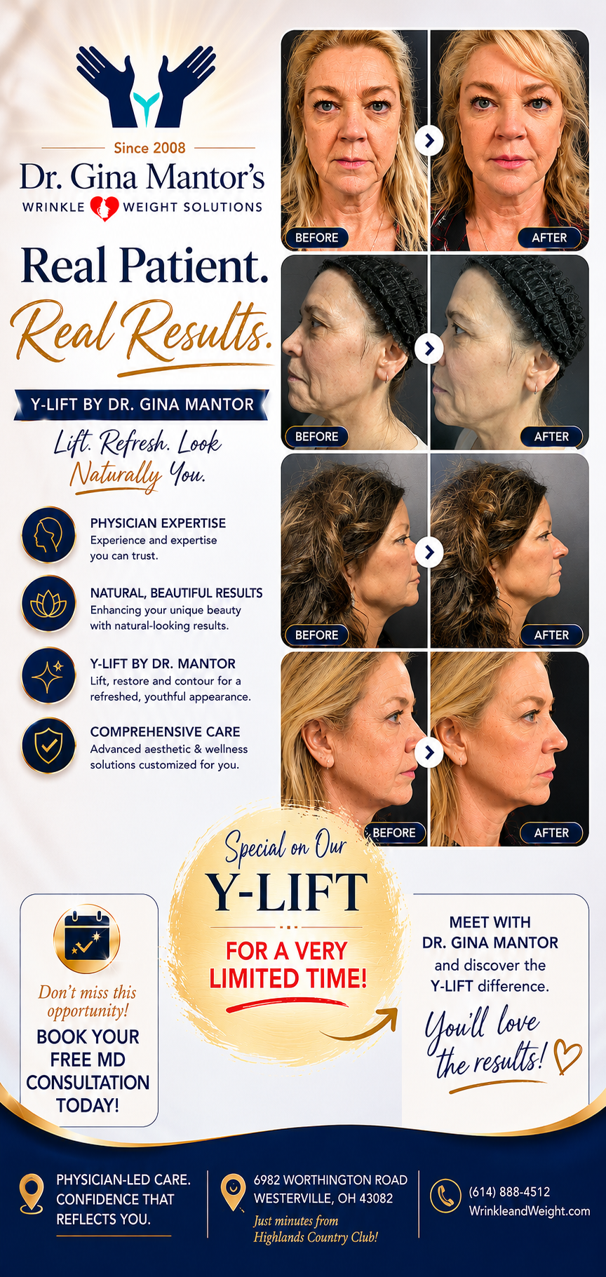 ✨ Real Patient. Real Results. Discover why patients across Central Ohio are choosing the Y-LIFT by Dr. Gina Mantor.