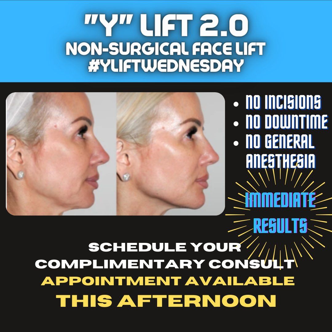 Y Lift Liquid Facelift Procedure Columbus Oh Dr Mantors Wrinkle And Weight Solutions Llc 