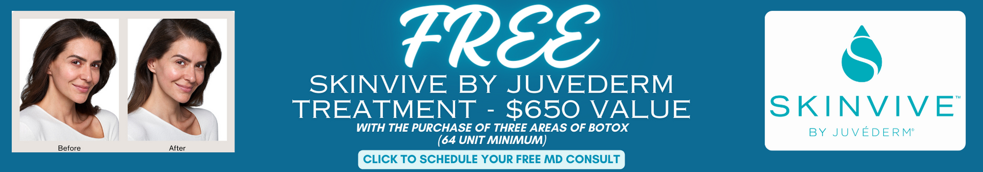 Free Skinvive by Juvederm Treatment with the purchase of BOTOX
