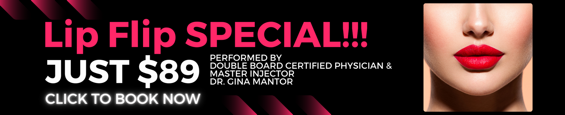 Lip Flip Special, Just $89 - Dr. Gina Mantor, Physician Injector