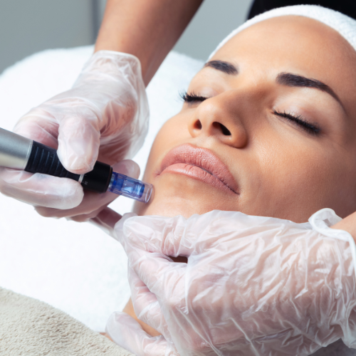 Dr. Mantor's Wrinkle and Weight Solutions, LLC - Westerville, Oh - Medical spa - microneedling special
