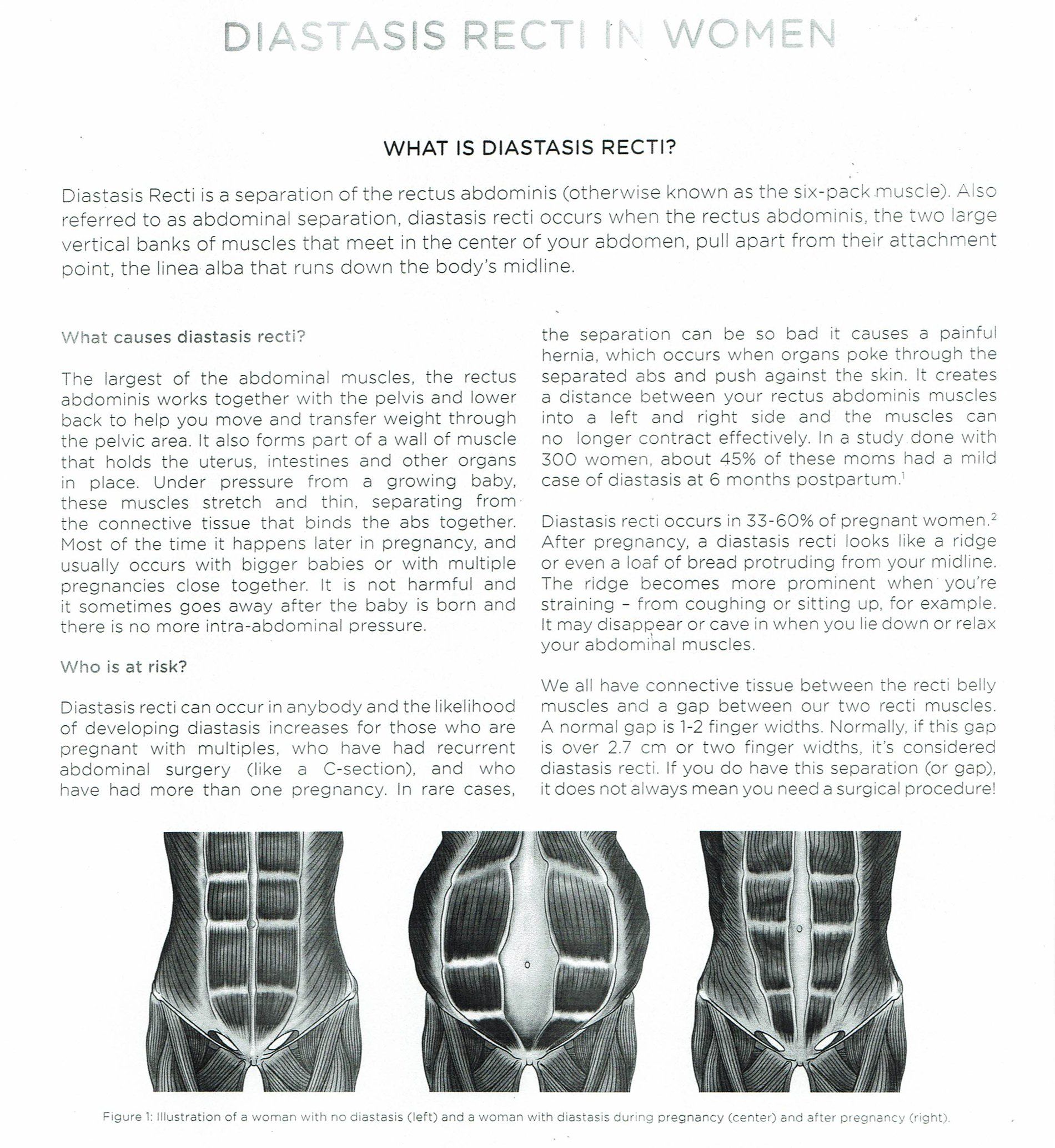 Free trials available! Reduce abdominal separation by 19% and enhance muscle building with advanced technology.