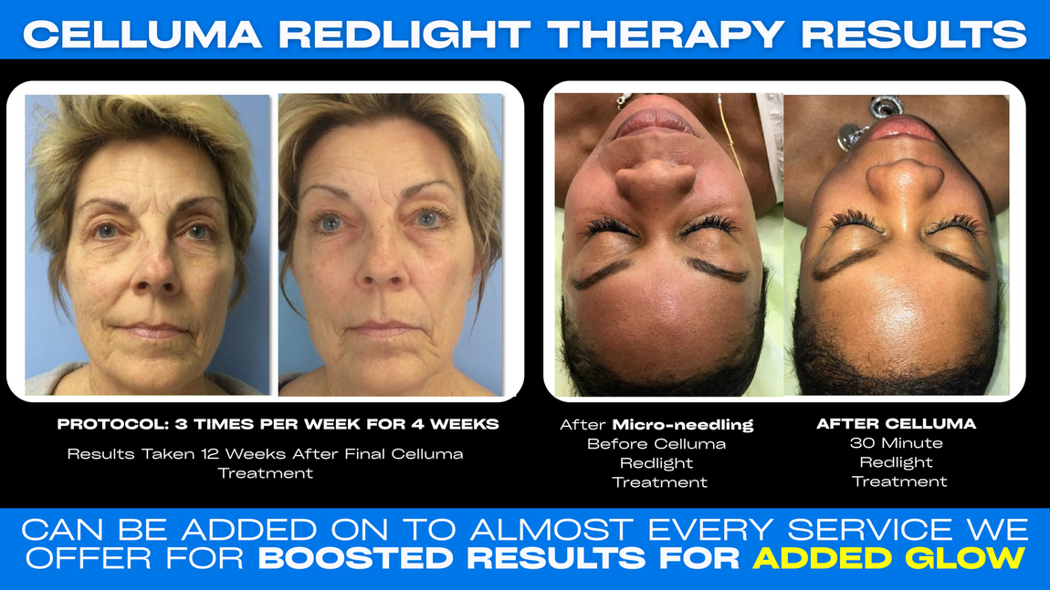Fall Beauty at Dr. Mantor's Wrinkle and Weight Solutions. Visit our Westerville Medspa today!