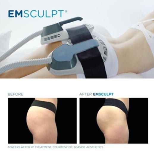 Emsculpt vs. CoolSculpting: Which Treatment is Right for You? Here are 4  Differences - Kalos Medical Spa