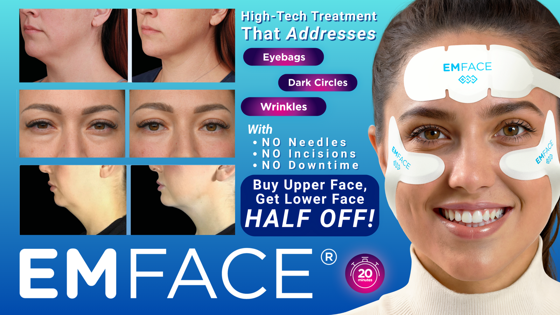emface - lift and tighten your face without needles, stitches at our westervile medspa