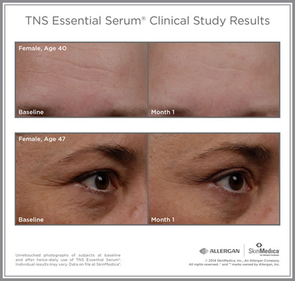 Essential Serum — TNS Essential Serum in Columbus, OH