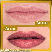 Permanent Lipline Color — Women Lips in Columbus, OH