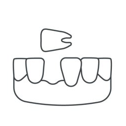 Schéma d'une bouche avec une dent manquante et une dent détachée au-dessus.