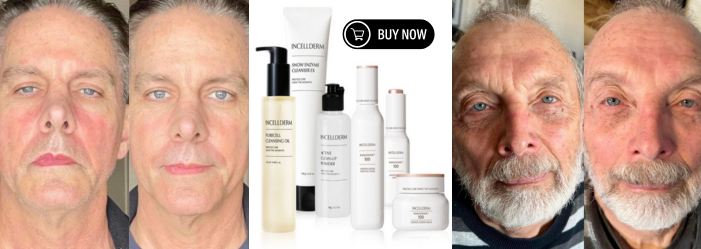 best korean skin care products for men