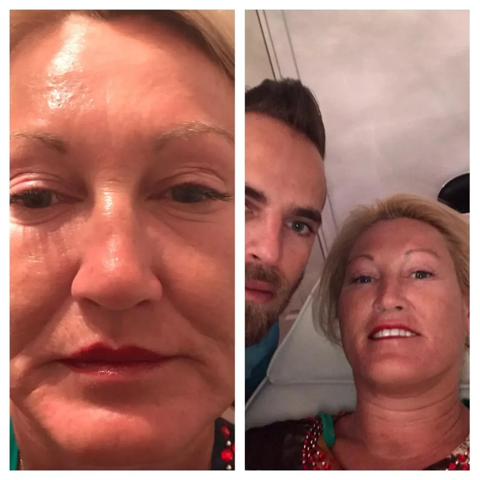 Woman's face before and after. Left close-up; right with man. Blond hair, reddish lipstick, visible lines.