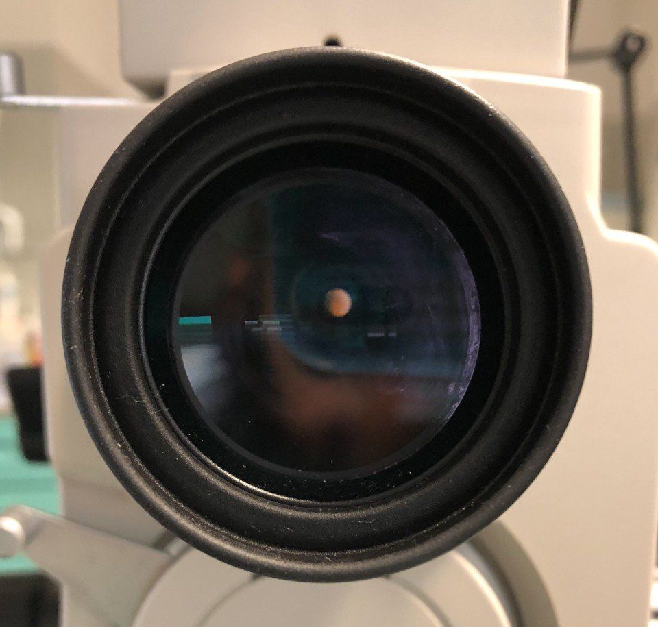 controllo della vista