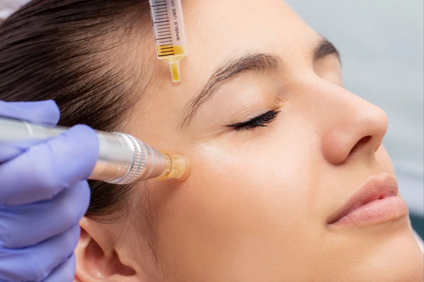 Person Undergoing Treatment — Embrace Cosmetic Clinic in Bundaberg North, QLD