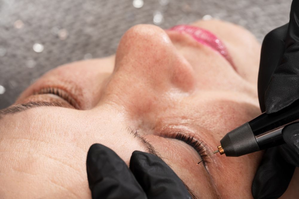 A Person's Eye Being Treated With a Device, for a Cosmetic Procedure — Embrace Cosmetic Clinic in Bundaberg North, QLD