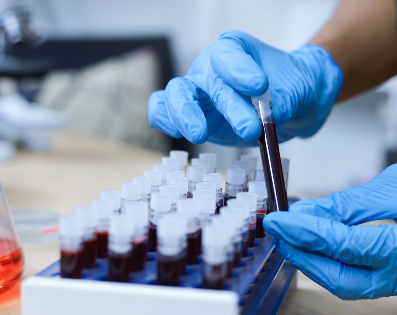 Drug Screening — San Diego, CA — Gaslamp Medical Center